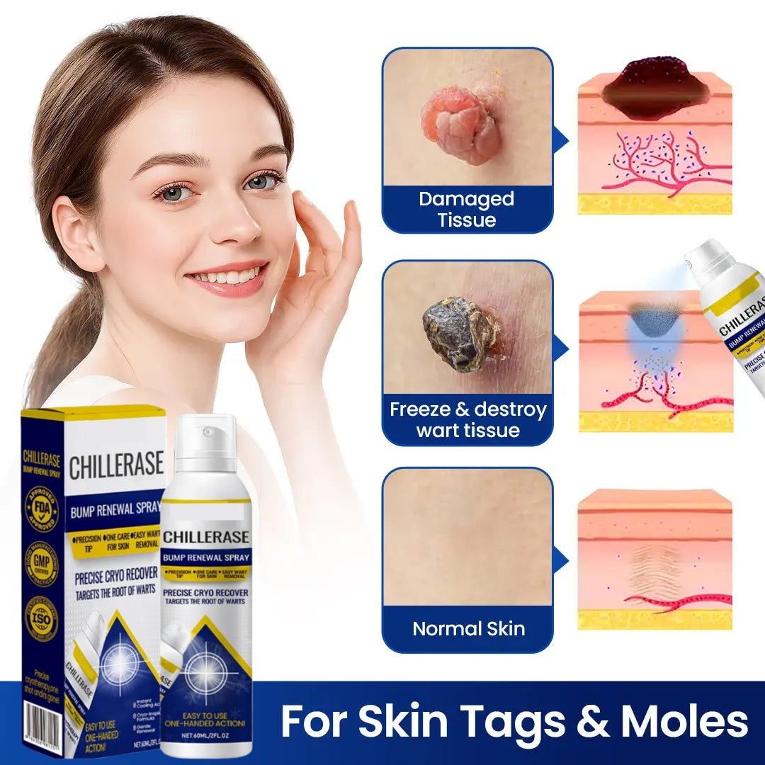 🔥Today's Deal🔥| Bump Renewal Spray