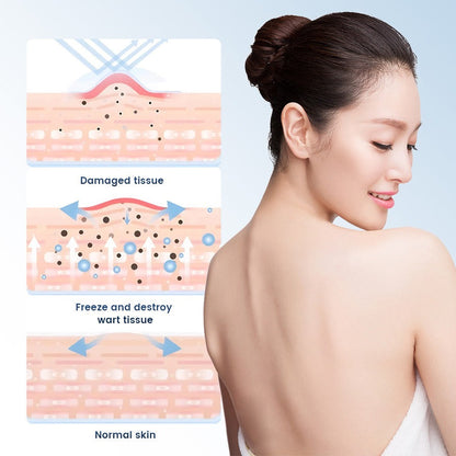 🔥Today's Deal🔥| Bump Renewal Spray