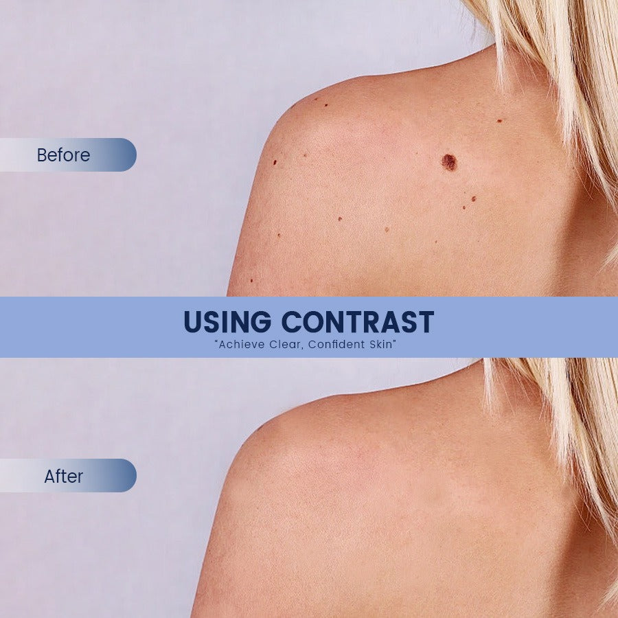 🔥Today's Deal🔥| Bump Renewal Spray